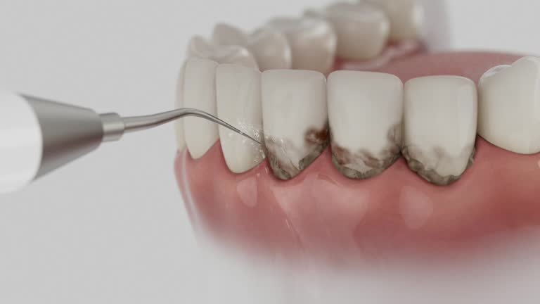 Reliable Dental contractor in Flora, IN by Dentist Open Now